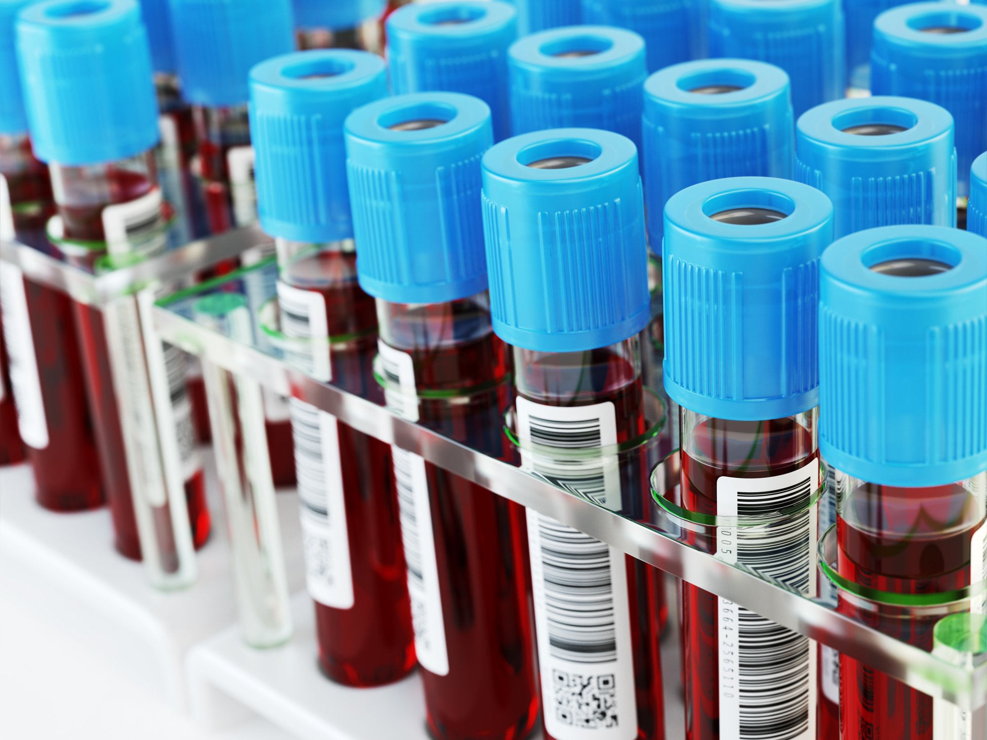 AdobeStock_Blood Test Tubes