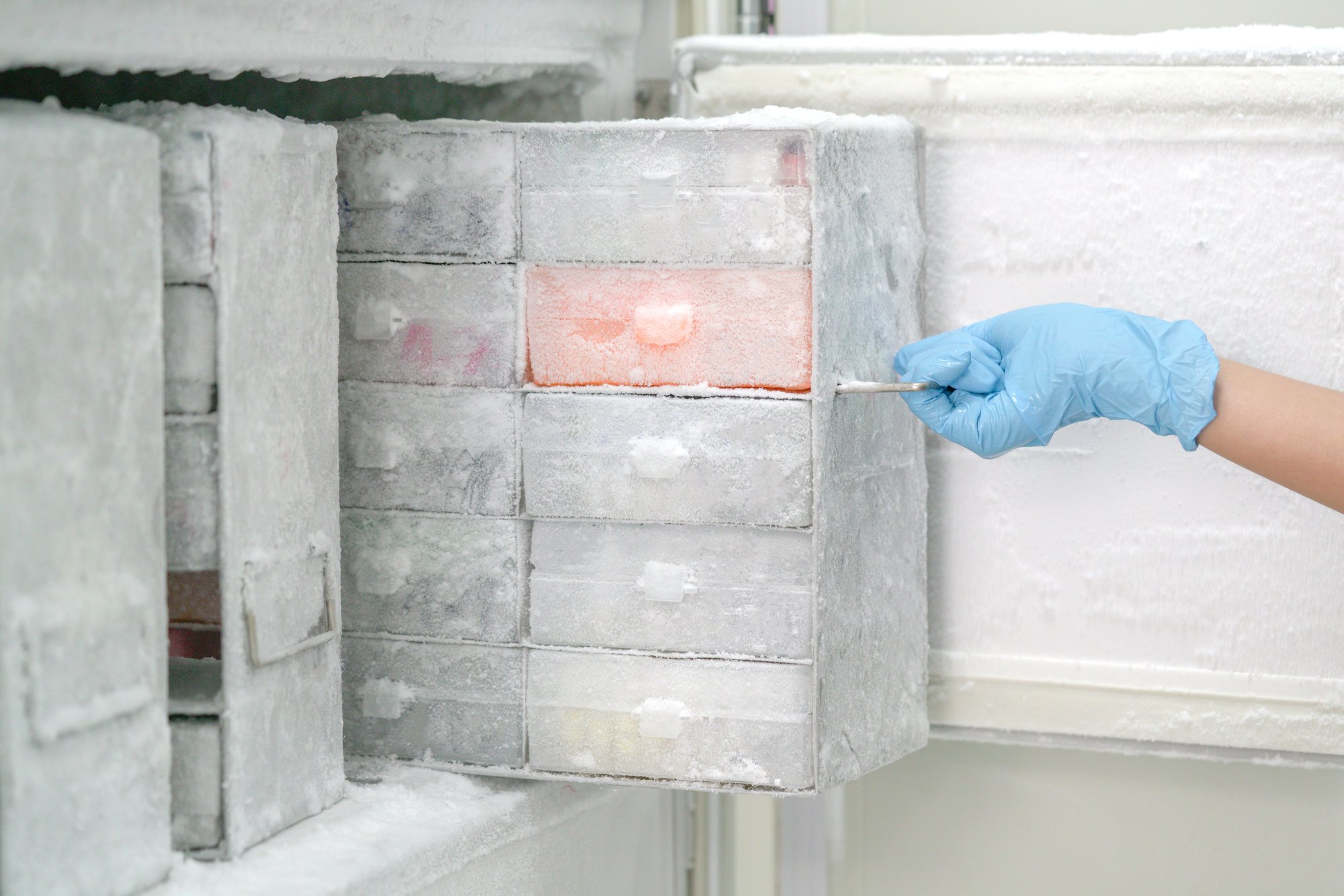 shutterstock_Removing Box From Freezer