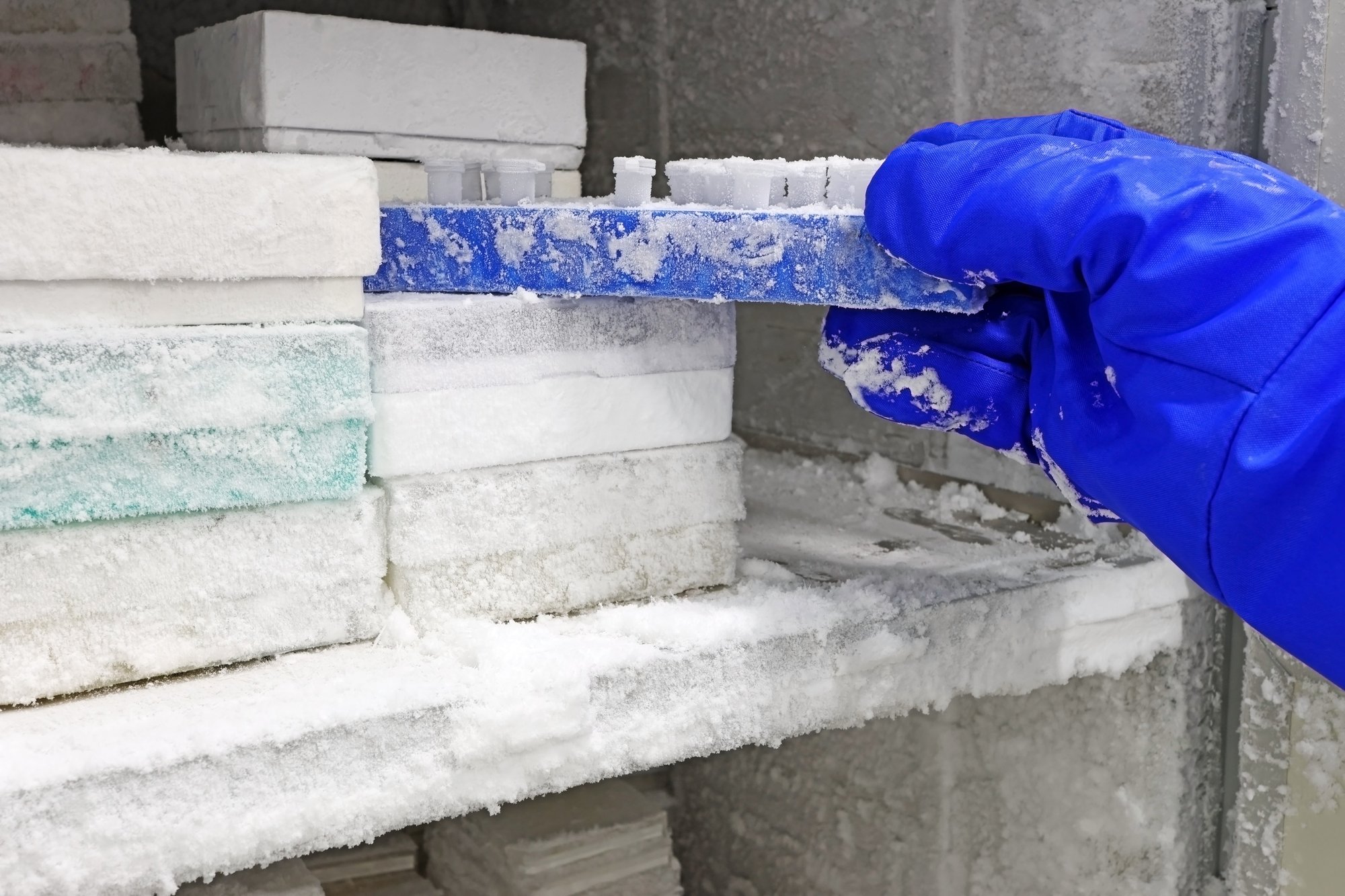 shutterstock_Removing Samples From Freezer